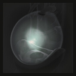 Newborn