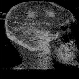 medial