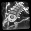 Centipede Stomper