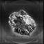 Medal of Honor