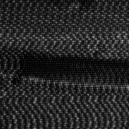 Ultraview Module