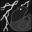 >VENT FRUSTRATION