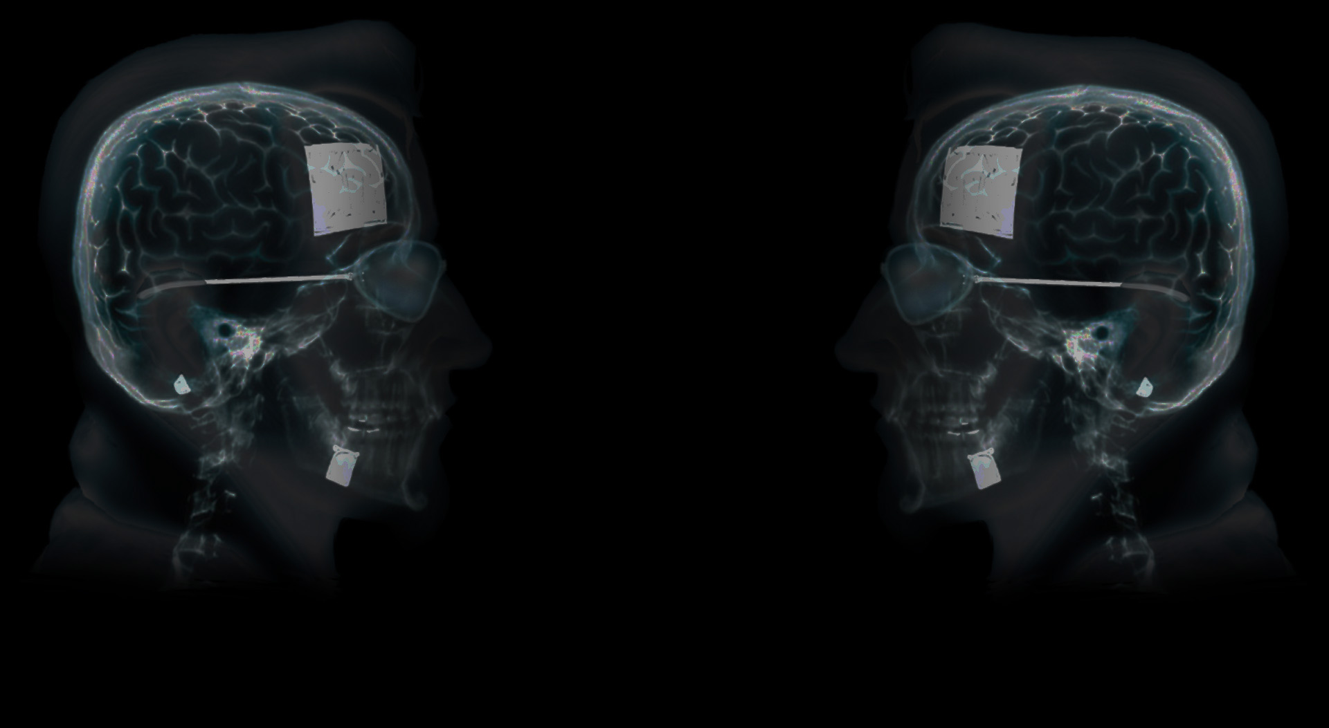 Dude X-Ray