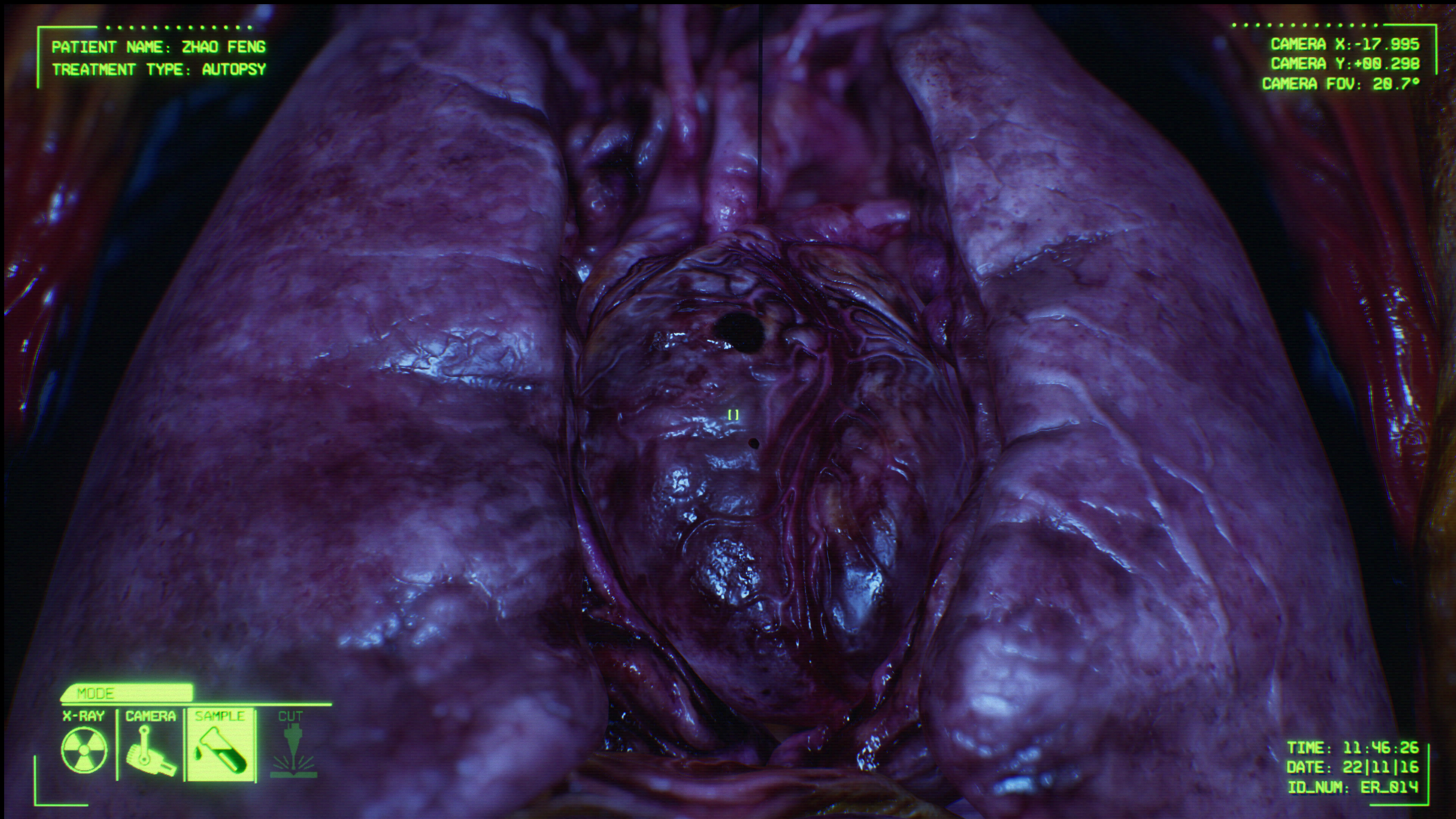 Negative Atmosphere: Emergency Room Prototype screenshot 6