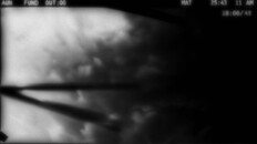 Teaser | Canary - Teaser