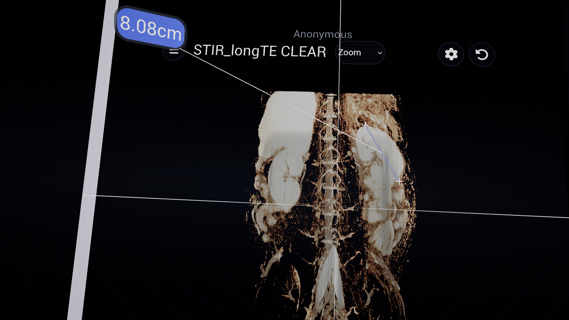 Bodyscope screenshot 4