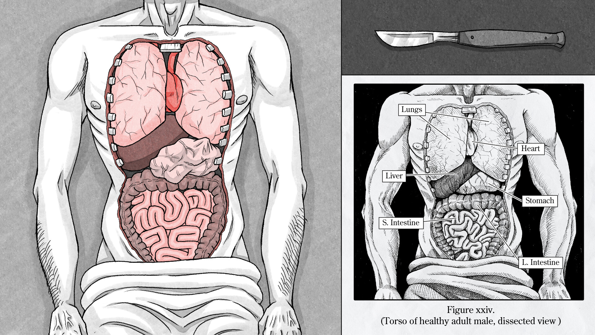 Edwin Earstwhile: Medical Examiner screenshot 5