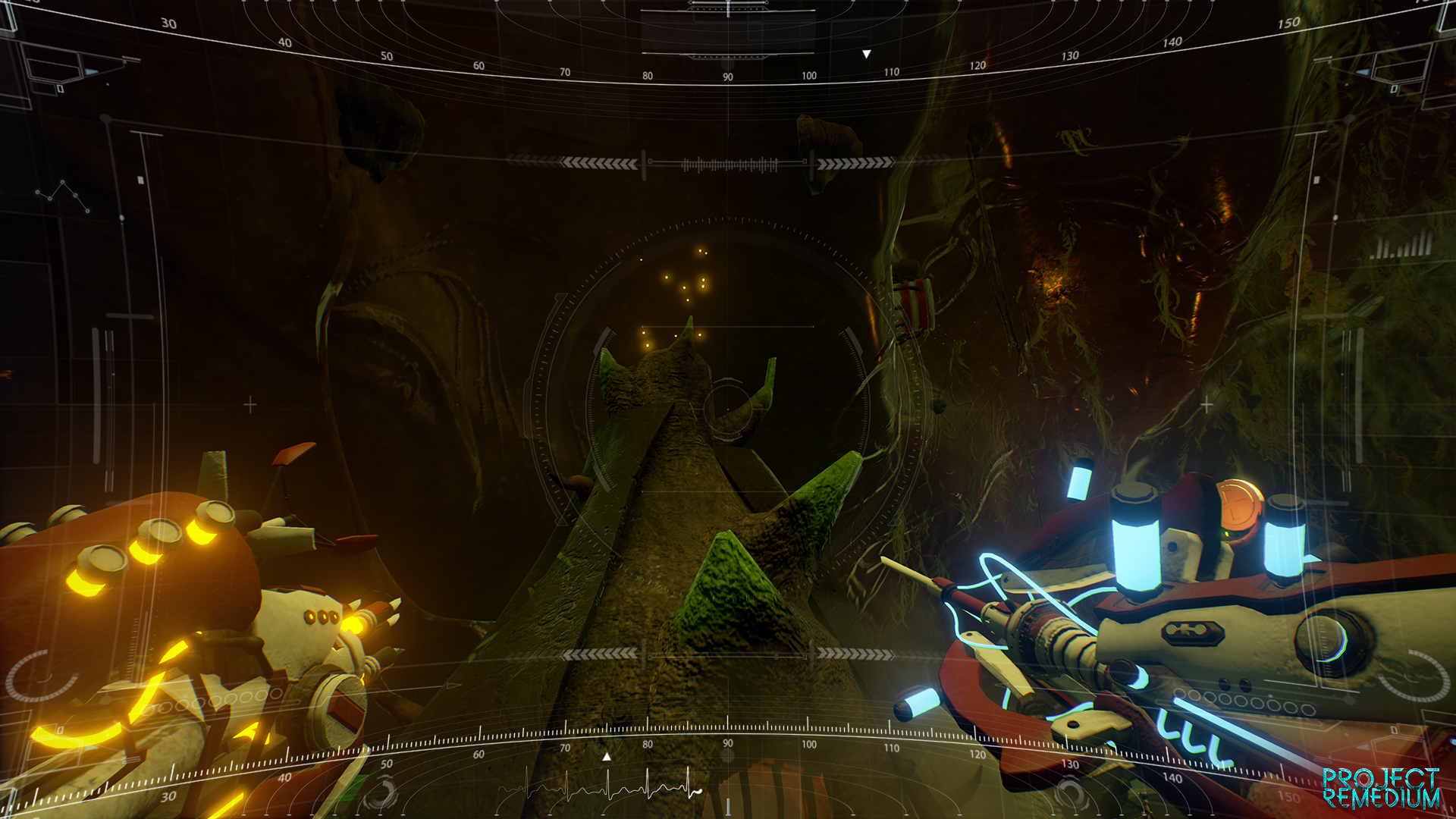 Project Remedium screenshot 51