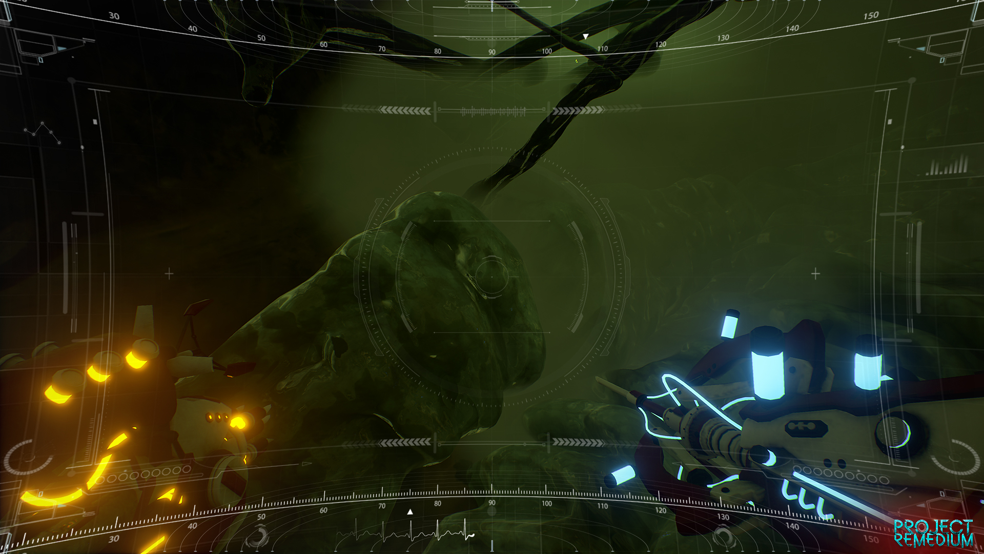 Project Remedium screenshot 27