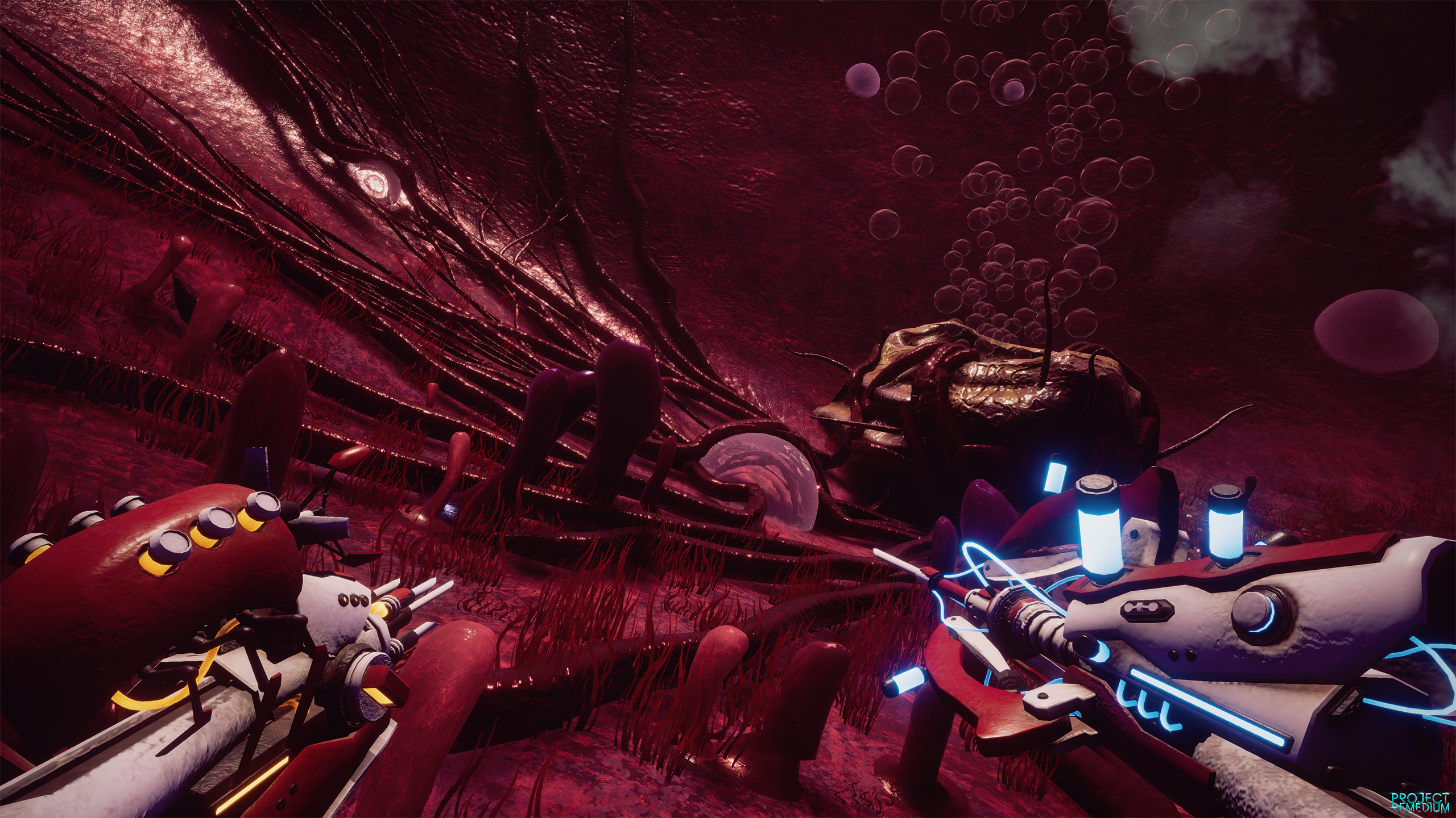 Project Remedium screenshot 67
