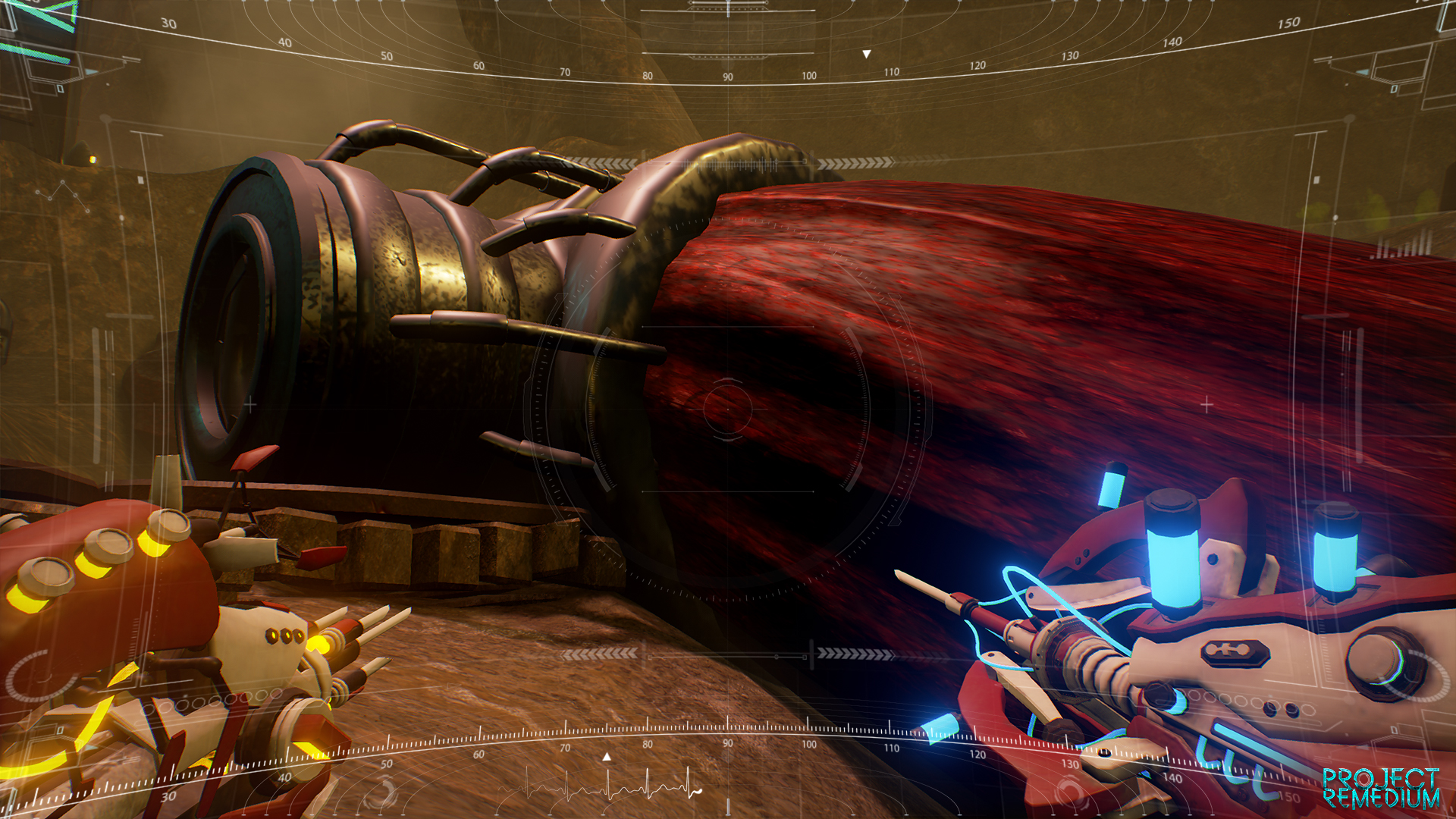 Project Remedium screenshot 18