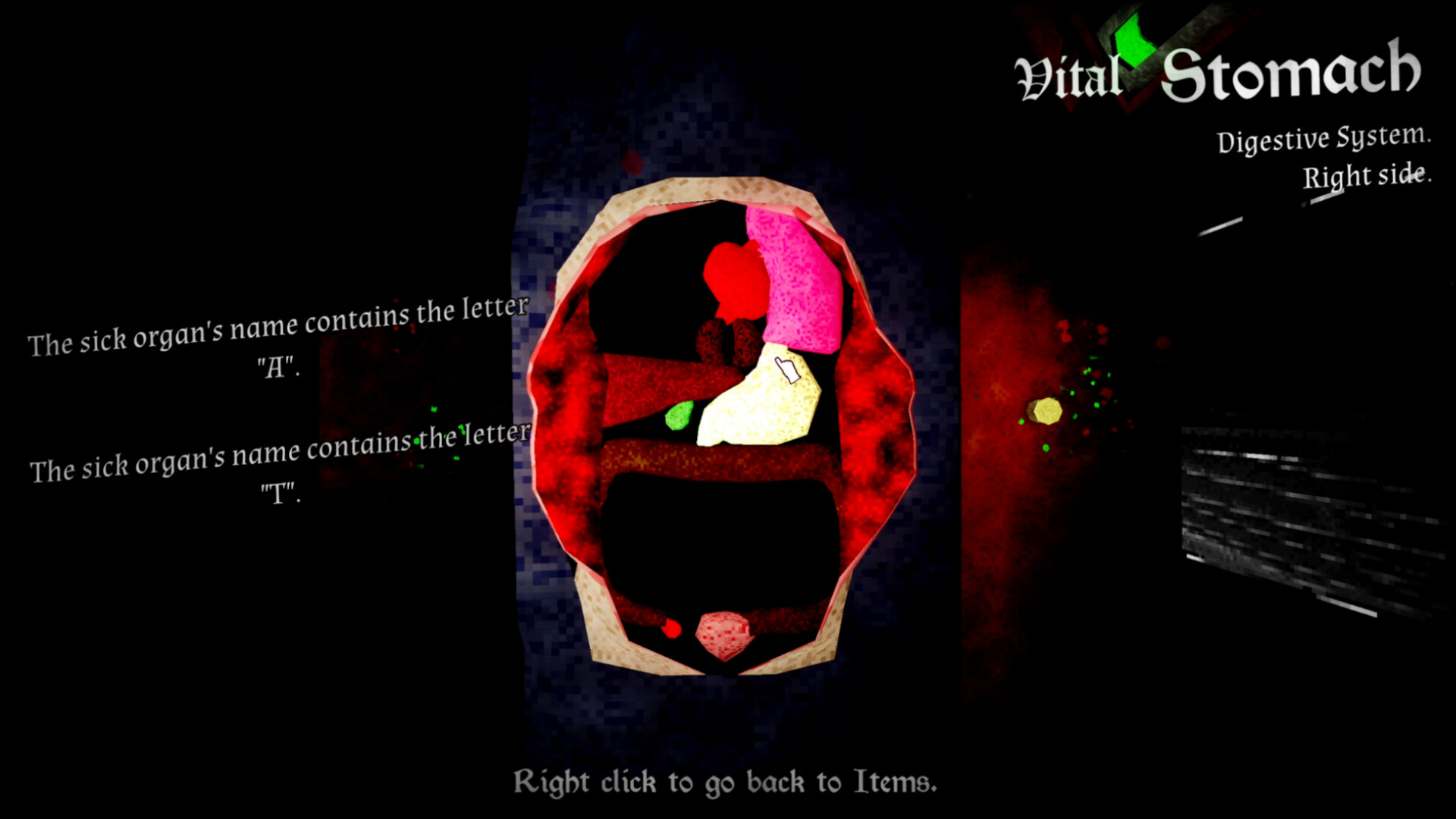 Organ Failure screenshot 4