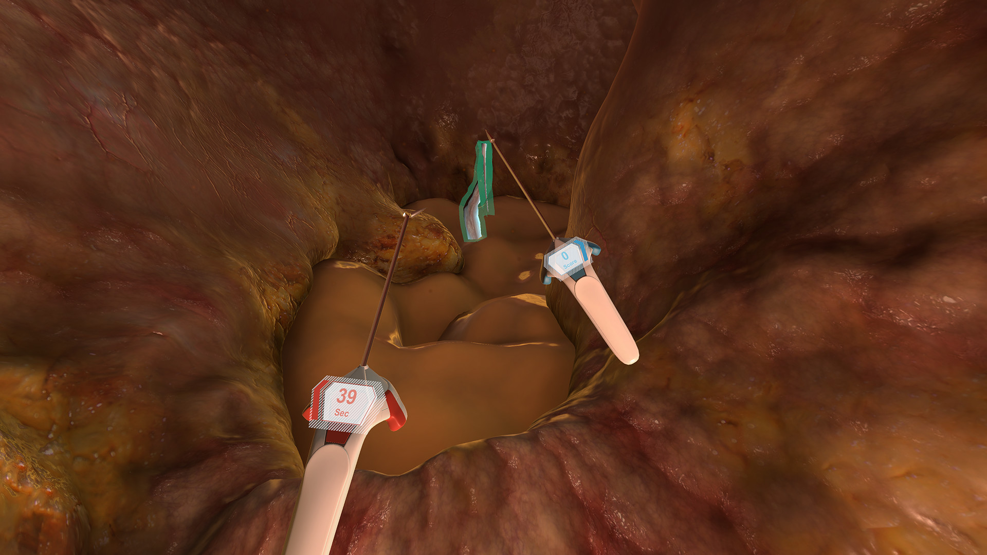 B. Braun Future Operating Room screenshot 6