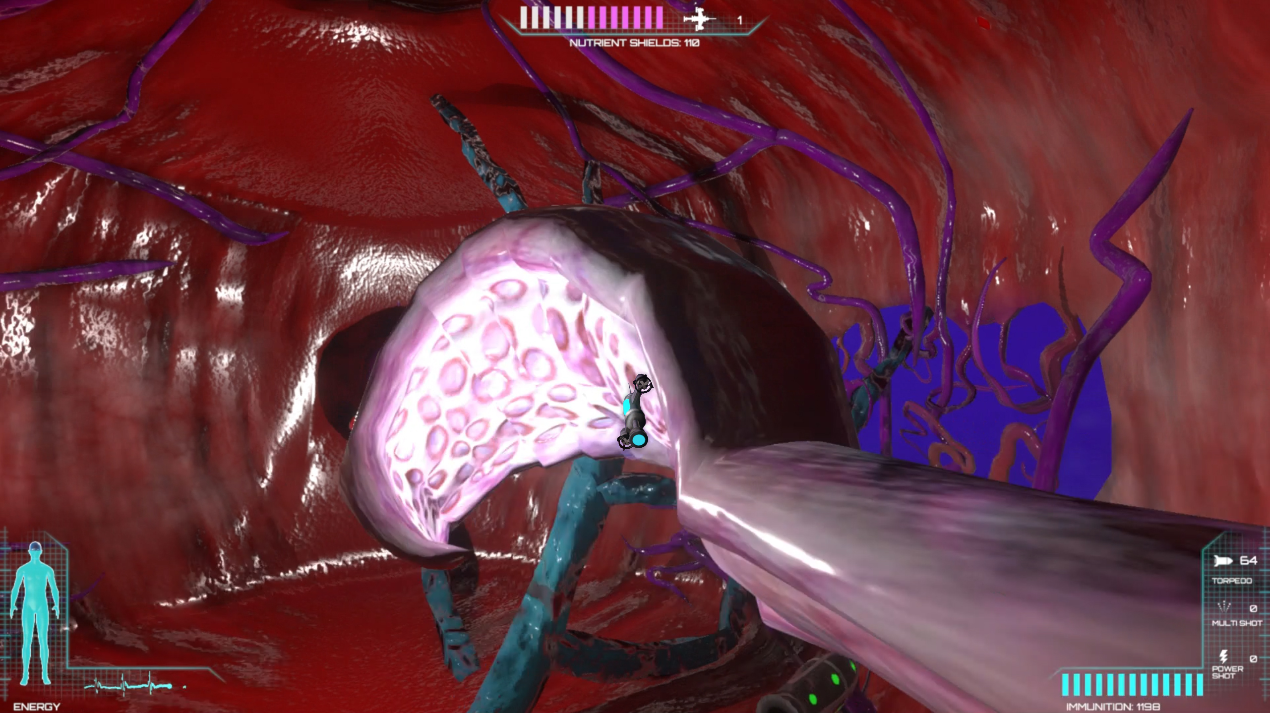 Placebo Effect screenshot 11